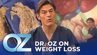 Dr Oz on Weight Loss  Oz Weight Loss [upl. by Jodi953]