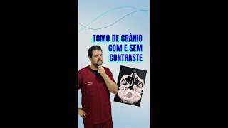 Diferença de tomo de crânio com e sem contraste ☢ [upl. by Katrinka]