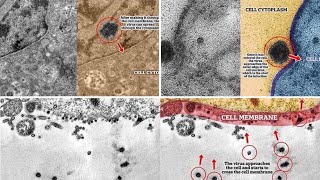 Moment of infection with coronavirus under microscope [upl. by Thaxter]