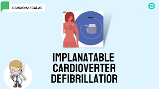 ICD Implantable Cardioverter Defibrillator [upl. by Rennug]