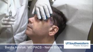 Anatomical Regional Targeted ART nerve blocks for Migraine Headaches [upl. by Fifi916]