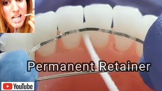 How to Clean Retainers Hawley Essix Clear etc [upl. by Eugine202]