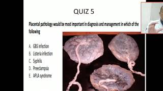 Case 6 how can placental examination help you for diagnosis and management Placental infections [upl. by Ennazor]