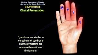 Median nerve injury causes symptoms diagnosis and treatment Carpal tunnel syndrome diagnosis [upl. by Nnairam]