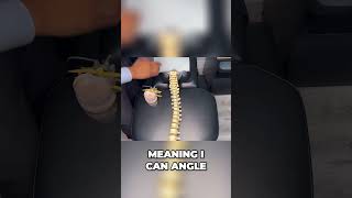 C5C6 Disc Bulge Treatment How Spinal Decompression Works  Dr Ruminder Birk [upl. by Notsew419]