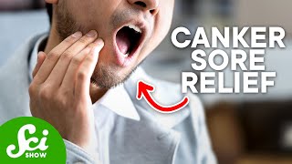 How to Get Rid of Canker Sores According to Science [upl. by Inahteb112]