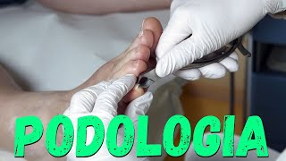 PODOLOGIA LIVE  Como tratar um Granuloma  CURSO Fórmula Podologia de Sucesso [upl. by Diad]