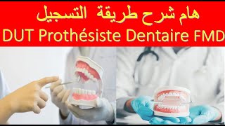 هام شرح طريقة التسجيل DUT Prothésiste Dentaire FMD [upl. by Trevor]