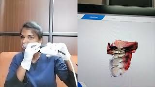 Digital Primescan Impression Challenge in Clinic Doctors challenge [upl. by Trah]