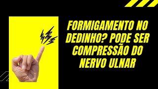 Formigamento no dedinho Pode ser Compressão do Nervo Ulnar [upl. by Kravits786]