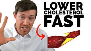 The BEST Way to Lower Cholesterol If You Have Hypothyroidism [upl. by Kally]