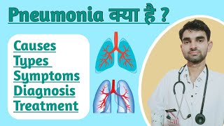 Pneumonia in Hindi  Causes Sing amp Symptoms of Pneumonia  Treatment of Pneumonia [upl. by Nyssa182]