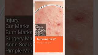 Mederma Cream For Injury Cut Marks Burn Marks Surgery Scar Scne Scar Pimple Marks [upl. by Atsirhcal]