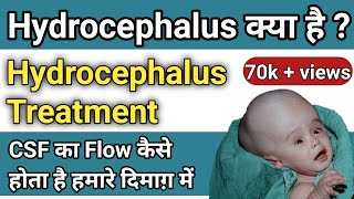 बच्चेदानी के मुख की सूजन  कारण और इलाज  CERVICITIS  UTERUS INFECTION  PID [upl. by Witherspoon]