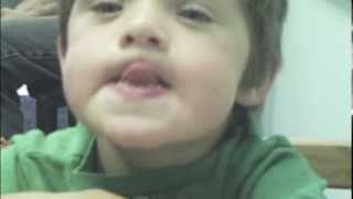 Dariens Journey with Childhood Apraxia of Speech [upl. by Ahsatel271]