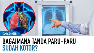 Tanda ParuParu Kotor dan Fungsi Penting ParuParu Dalam Tubuh Manusia  Kata Dokter [upl. by Donnamarie]