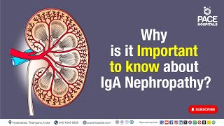 IgA Nephropathy Important  Why is it Important to know about IgA Nephropathy  iganephropathy [upl. by Yma]