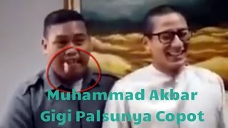 Lucu Muhammad Akbar Sang Ajudan Pribadi Gigi Palsunya Copot Saat Ketemu Sandiaga Uno [upl. by Winson147]