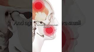 Temporalis Muscle Trigger Points [upl. by Aenal42]