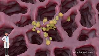 Unterschiede in den Symptomen zwischen Lungenkrebs und COPD [upl. by Anilorac]