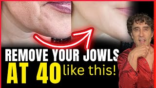 GET RID OF YOUR JOWLS WITHOUT SURGERY  Complete Guide 2024 [upl. by Milah733]