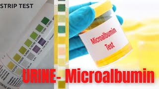 URINE MICROALBUMINCREATININE TEST Strip [upl. by Nahsez]