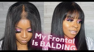 How To Fix a Bald Spot On A Lace Front Wig [upl. by Bluhm]