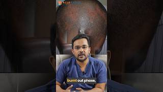 Diagnosis amp Treatment of Scarring Alopecia  Dr Alok Sahoo  alloroots [upl. by Faletti]