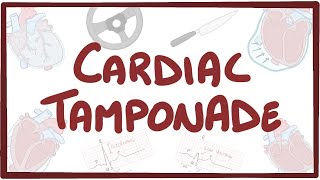 Cardiac tamponade  causes symptoms diagnosis treatment pathology [upl. by Ackler]