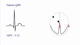 ECG QRS Complex [upl. by Anneirda]