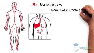 Rheumatology – Polyarticular Pain By Lori Albert MD [upl. by Nugent]