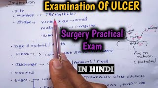 Examination Of Ulcer In Surgery  Ulcer Examination  Surgery Practical Exam [upl. by Jamel]