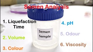 Semen Analysis Test Lab  Liquefaction time Volume Colour pH Odour Viscosity Test [upl. by Rodgers]