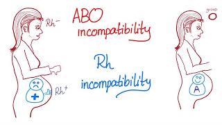 ABO incompatibility vs Rh incompatibility [upl. by Magdaia]