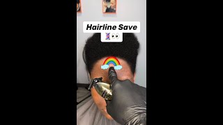 Craziest Hairline Save Ever of 2024 ✂️💈 [upl. by Gardener370]