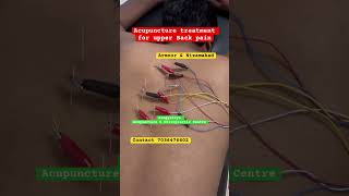 Are you suffering from upper back pain healthtips physiotherapy acupuncture acupressure newreel [upl. by Riek803]