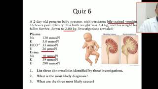 Case 6 what are the causes of acute kidney injury  Pre renal failure [upl. by Ire]