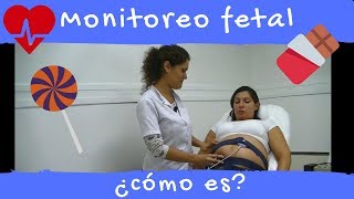 Así es un monitoreo fetal [upl. by Alded702]