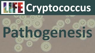 Cryptococcal meningitis pathogenesis and host response [upl. by Shalne]