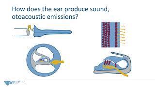 Otoacoustic emissions OAE  Introduction for newborn hearing screening programs [upl. by Eanad]