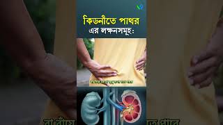 কিডনীতে পাথর এর লক্ষণসমূহ । Causes of kidney stone I kidney disease I sasthosebok [upl. by Onin]