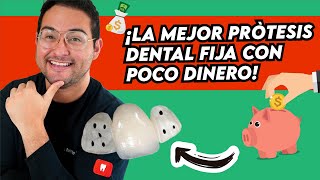 ¿Necesitas PROTESIS DENTAL ¡deberías ver este video ¡la mejor FIJA CON POCO DINERO 😍 [upl. by Ayahsal]