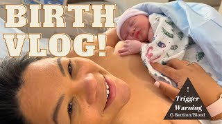 EMOTIONAL BIRTH VLOG  CSECTION VLOG 2022  GRAPHIC CONTENT WARNING  Labor and delivery [upl. by Llegna]