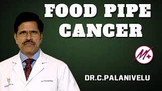 Adenocarcinoma  Food Pipe Cancer  Esophageal Cancer   DrCPalanivelu [upl. by Dera]