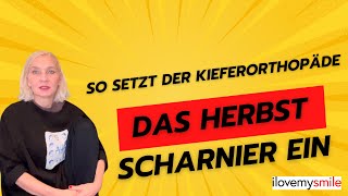 Herbstscharnier Wie setzt der Kieferorthopäde ein Herbstscharnier ein [upl. by Aelegna]