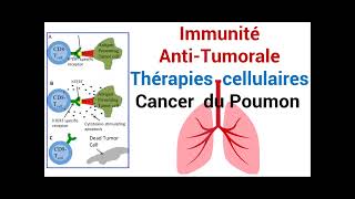 Cancer du Poumon Réponse de lImmunité AntiTumorale Thérapie cellulaire [upl. by Etnuaed]