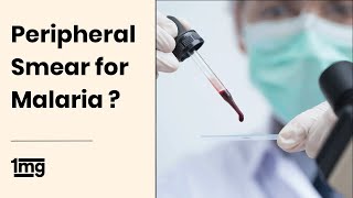 Peripheral Smear for Malaria Slide Test  1mg [upl. by Nahte]