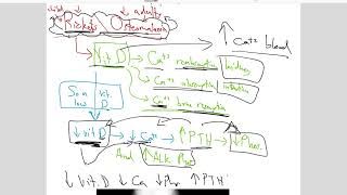 Osteomalacia I Rashid Abu Helwa I Pathology Made Easy [upl. by Tybi]