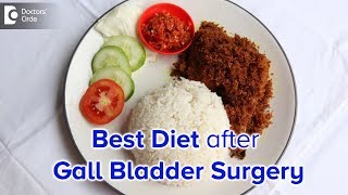 Diet after Laparoscopic Cholecystectomy Gall bladder surgery  Dr Nanda Rajaneesh [upl. by Campball]