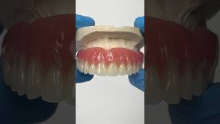 Reline Denture lsk121shorts dentistry teeth [upl. by Frodin]